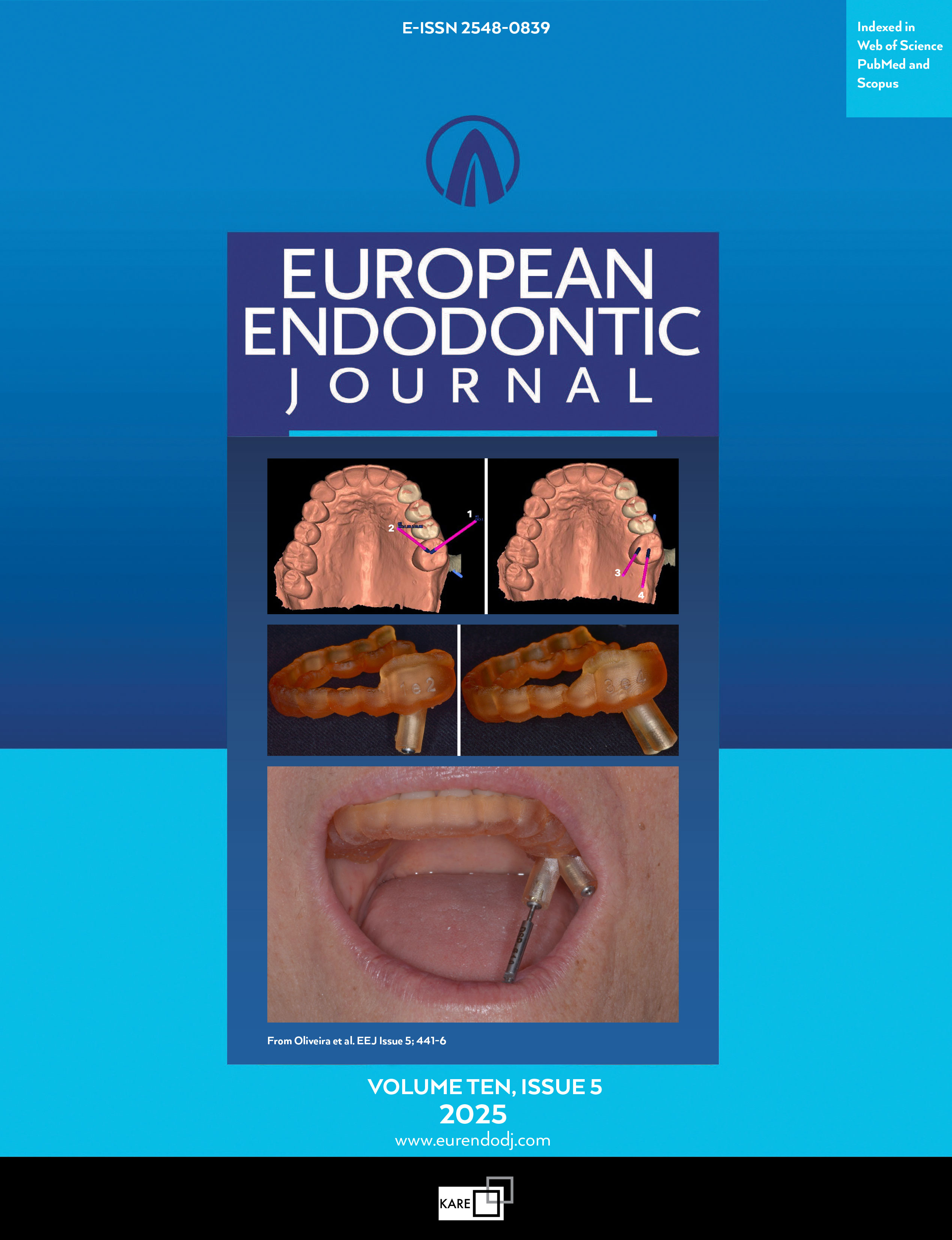European Endodontic Journal - Eur Endod J: 9 (2)